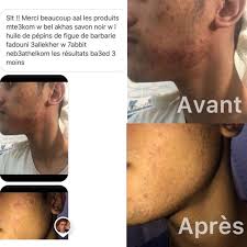 Processus d'extraction d'huile de pépins de figue de barbarie par huilerie ben selmaprickly pears seeds oil, cactus. Karina Tunisie Un Succes Indeniable Savon Noir A La Facebook