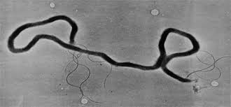 Image result for Treponema