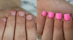 But most women go for long acrylics, can i get short acrylic nails then?. How To Fix Short Bitten Nails With Acrylic Youtube