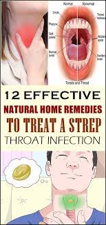 12 Effective Natural Home Remedies To Treat A Strep Throat Infection Throat Infection Strep Throat Natural Headache Remedies