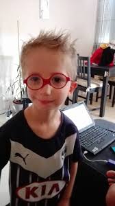 Gilles de la tourette syndrome. Syndrome De Goldenhar Kylian Home Facebook