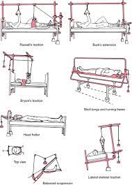 Buck s traction for fractured hips. Traction Hook Definition Of Traction Hook By Medical Dictionary