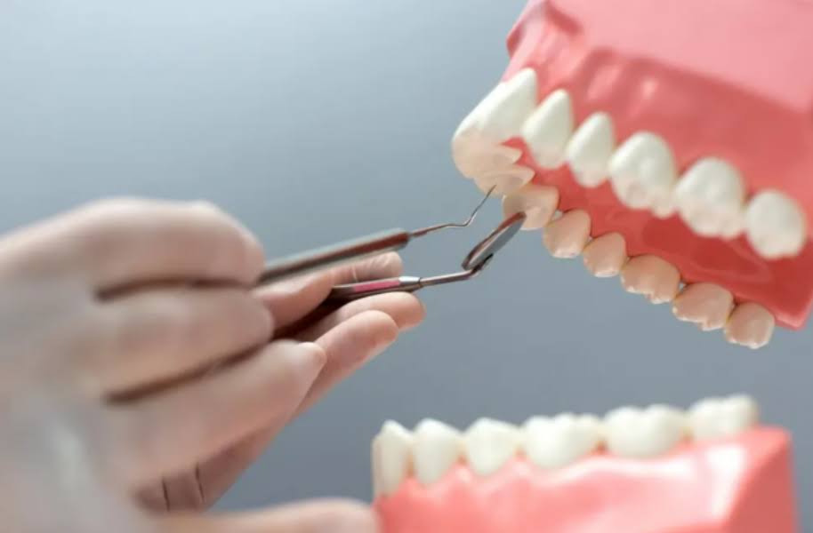 Dental Plaque product image
