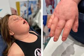 Ultra-realistic Down's Syndrome girl simulator