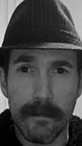 Surviving a Brain Aneurysm: Andrew's Journey of Resilience and Purpose