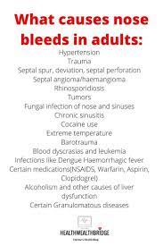 Bleeds Nose I Am An Ent Surgeon And On Healthwealthbridge I Discuss What Causes Nose Bleeds In Adults Nose Bleeds Nose Health And Wellness Quotes