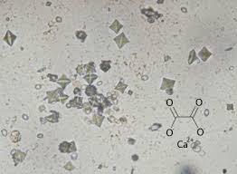 Gli ossalati sono composti indigeribili contenuti in certi alimenti che impediscono il corretto assorbimento di alcuni nutrienti. Calcoli E Renella Nel Gatto Sintomi Cura E Prevenzione Miciogatto It