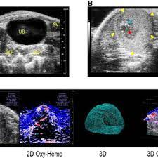The main topic of diagnostic imaging is an improvement of prostate cancer diagnosis. Representative 2d Ultrasound Images Of Prostate And Prostate Tumor Download Scientific Diagram