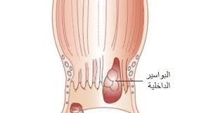 علاج البواسير الداخلية نهائيا وبدون رجعة التخسيس السريع Slip On Sneaker Sneakers Hemorrhoids