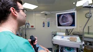 Image result for Colon Cancer Screening with Colonoscopy