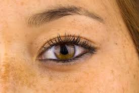 The past two decades has seen more media attention focusing on the detrimental effects of the sun, especially when it there is a gradual damage of the skin, over months and even years. 455 Sun Damaged Skin Photos Free Royalty Free Stock Photos From Dreamstime