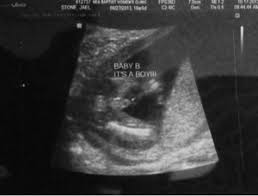 Ultrasound For Gender April 2014 Babies Forums What To Expect