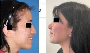 Dra. Gabriela Angulo Pérez Otorrinolaringólogo, Naucalpan De Juárez