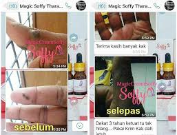 Cara menghilangkan ketombe dengan minyak kelapa. Cara Hilangkan Ketuat Kutil Biji Kolestrol Facebook