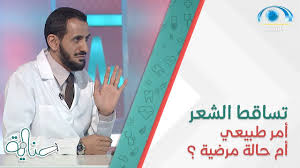 متى أعرف أن تساقط الشعر أمر طبيعي أم حالة مرضية Youtube