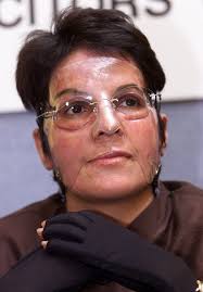 Paddington rail crash survivor reveals how she overcame her burns injuries 