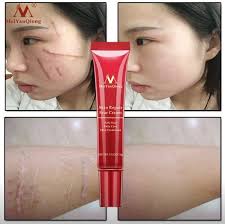 معالج الجروح والحروق والخدوش والبشرة المتضررة من سوق فورديل حمل البرنامج Acne Scar Removal Skin Repair Acne Spot Treatment