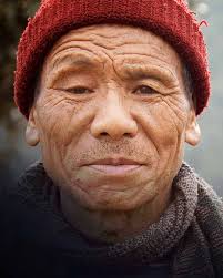 Acupuncture Relief Project