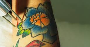 Our location is one of a kind because we offer lidocaine injections to limit the amount of pain felt during the removal session. Tattoo Removal Miami Gardens Fl