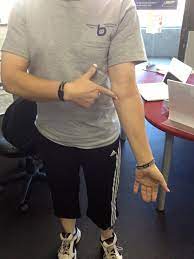 Golfer's elbow is not exclusive to golfers but is named so because of its prevalence among golfers and those who play or do similar activities (particularly those involving some gripping or clenching of. What Causes Tennis Elbow And Curing Tennis Elbow How To Finally Get Rid Of Your Nagging Elbow Pain B Reddy Org