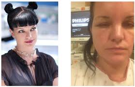 These allergic reactions are characterized by redness, inflammation, itchiness, and, in more severe cases, the swelling of the skin around the hair line, neck, beard so, how long does it take until the nasty symptoms of an allergic reaction are gone? What You Need To Know About Para Phenylenediamine Ppd Ancient Sunrise
