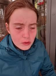 MP writes to Sajid Javid over young woman's treatment at Southmead Hospital 