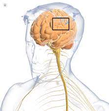 University of rochester center for health + technology. Amyotrophic Lateral Sclerosis Als What Is It Symptoms Causes Prevention And Treatment Top Doctors