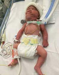 The exact cause of womb cancer is not known, but certain things can increase a woman's chance of getting it. Miracle Baby Survived Cancer While Still In Her Mother S Womb Mirror Online