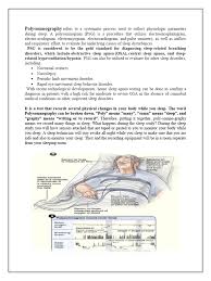 Image result for Polysomnogram