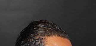 Il prezzo minimo è 1200 € e il prezzo massimo è 1500 €. Trapianto Capelli Con Micro Fue In Italia Clinic Biorigeneral