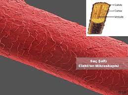 Sacin Yapisal Anomalileri Sac Saft Anomalileri