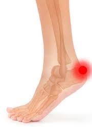Achilles Tendonitis Vs Achilles Bursitis Mike Ryan Fitness Achilles Tendonitis Achilles Bursitis Bursitis