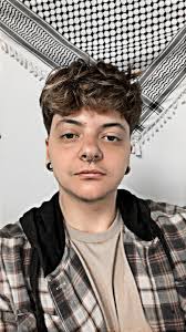 Jade plant heat damage recovery tips needed