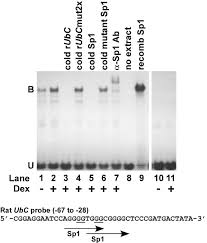 Please choose a directory from the following list: Ubiquitin Ubc Expression In Muscle Cells Is Increased By Glucocorticoids Through A Mechanism Involving Sp1 And Mek1 Sciencedirect