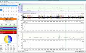 Sleepyhead And Sleepmapper Leak Rate Discrepancy Cpaptalk Com