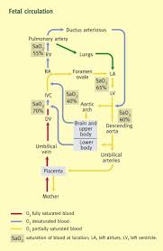 Image result for Delayed Transition from Fetal Circulation