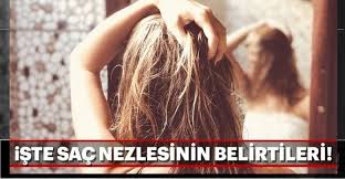 Sac Nezlesi Nedir Iste Sac Nezlesinin Belirtileri