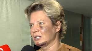 🏆eleita melhor parlamentar de sp e única mulher nos top4 ( @rankingdospoliticos) 🎙jornalista. Caso Joice Veja Quais As Reacoes Que Remedio Usado Por Deputada Pode Causar Saude Ig