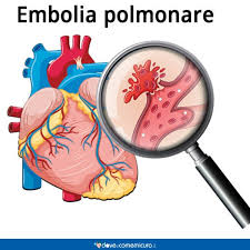 Consultare immediatamente un medico se si manifesta le cause. Dolore Al Petto Sinistro O Destro Cause Sintomi E Rimedi