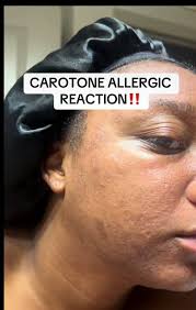 Sold🙏❤️8 piglets FRIVATE OTFORHIRE VArangerin