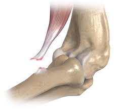 Hier sind brennende schmerzen oder taubheit an der außenseite des ellenbogens die folge. Verletzungen Des Ellenbogens Medcenter Bayreuth