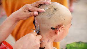 One such study , conducted by two scientists, l.lynfield and peter macwilliams proved that shaving does not really affect the growth of hair in any way. Mundan Ceremony How Effective Is It For Baby S Hair Growth