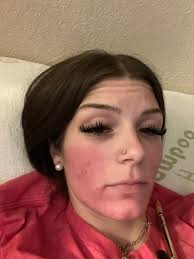 It's my first time using home tester club and I've been sent the cetaphil  cleanser. For my before and after photo does it have to be of my entire  face? Or can