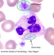 Can high neutrophils indicate cancer? Excite Your Inner Science Nerd Find Rbc Wbc Inclusions Med Lab Study Hall