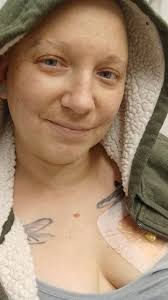 Support for classmate with cancer diagnosis