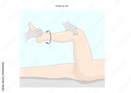 Image result for McMurray Test