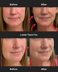 If it's anti-aging, we are in! 😂