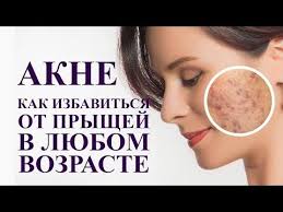 маски от пятен после прыщей на лице в домашних условиях Akne Kak Izbavitsya Ot Pryshej V Lyubom Vozraste Prostoe Sredstvo Ot Pryshej Youtube Naturalnye Maski Dlya Lica Lechenie Akne Lechenie Pryshej
