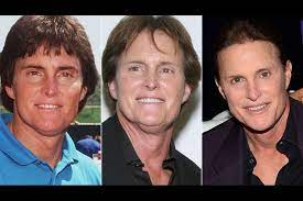 One of the most famous athletes of the 1970s, bruce jenner (born 1949) won the gold medal in the decathlon in the 1976 olympic games. Diane Sawyer S Bruce Jenner Interview I Call Bullshit Chicago Tribune