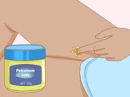 Many people get rid of boils through popping. 3 Simple Ways To Get Rid Of Boil Scars Wikihow
